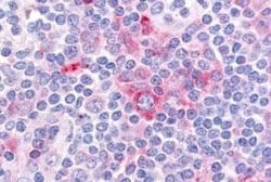 GPR62 Antibody, Novus Biologicals 50 &mu;g | Buy Online | Novus Biologicals | Fisher Scientific